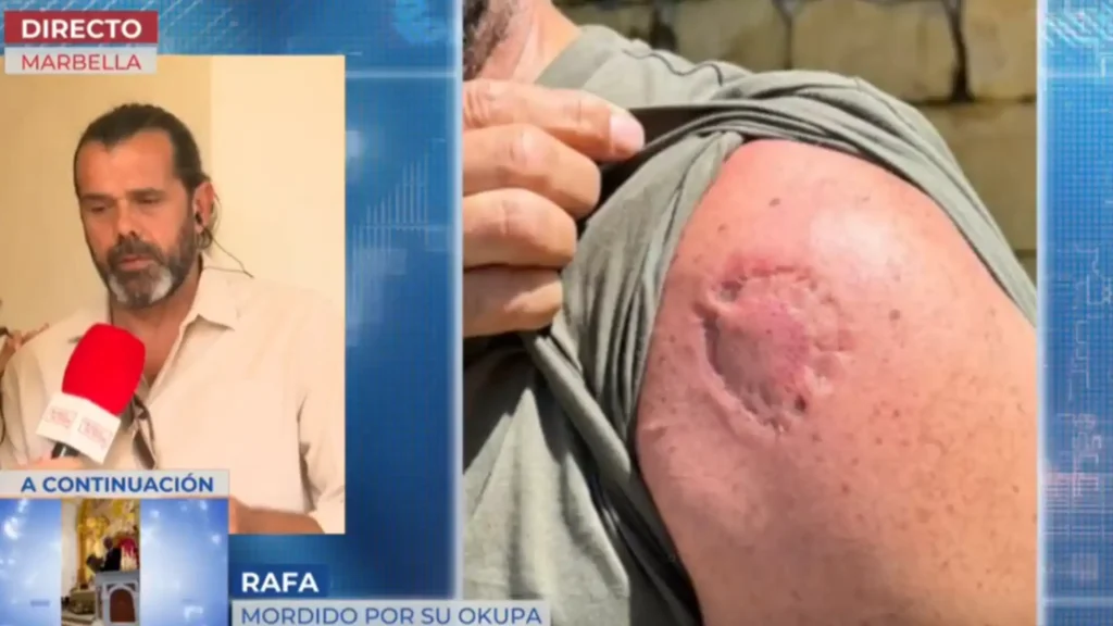 La Impactante Historia del ‘Okupa Caníbal’ que Atacó a su Propietario