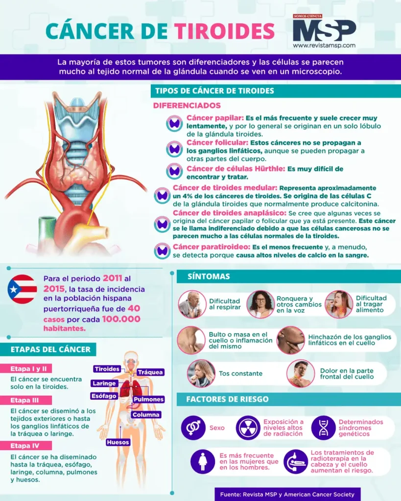 Cáncer de Tiroides: Reconociendo los Síntomas y Opciones de Tratamiento