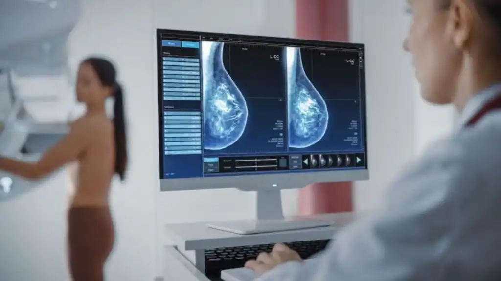 Mamografía: La Clave para la Detección Temprana del Cáncer de Mama