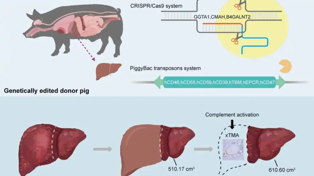 Un Hito en la Medicina: Trasplante de Hígado de Cerdo Modificado Genéticamente