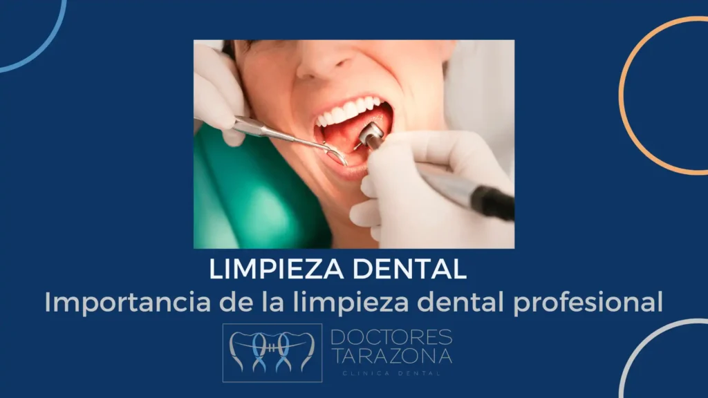 La Importancia de la Limpieza Dental Profesional: Frecuencia y Beneficios