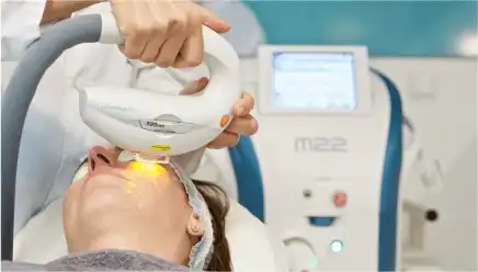 Innovaciones en el Tratamiento del Ojo Seco: Luz Pulsada como Solución Efectiva