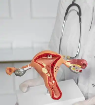 Entendiendo la Endometriosis Extrapélvica: Un Desafío Médico