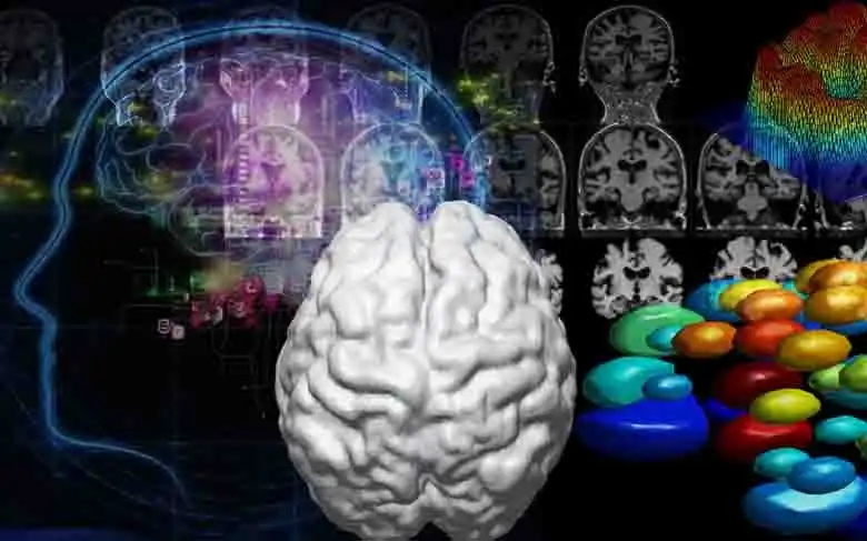 Avances en la Investigación de Enfermedades Neurodegenerativas a Través de la IA