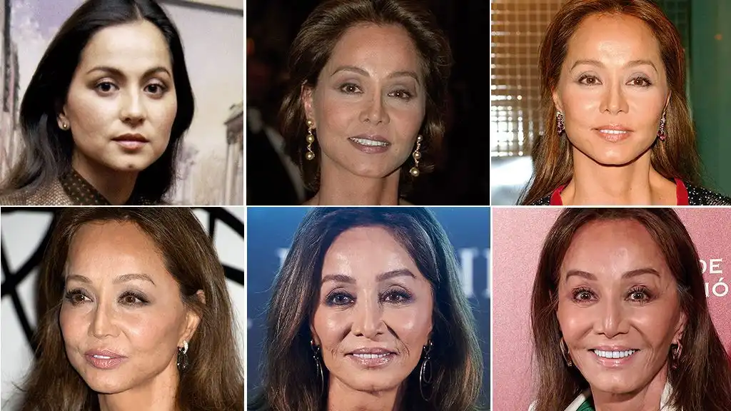 Isabel Preysler y su historia de cirugías: un viaje por la búsqueda de la perfección