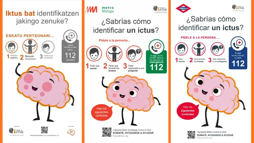 El Ictus en Málaga: Un Problema Creciente y Cómo Combatirlo