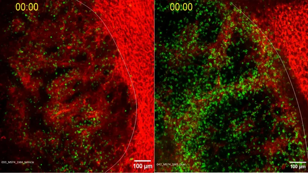 Nuevas Revelaciones sobre la Resistencia de Tumores Colorrectales a la Inmunoterapia