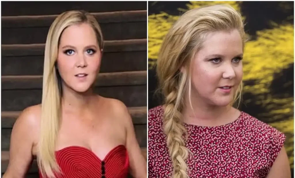 La Transformación de Amy Schumer: Un Viaje hacia la Salud y la Autoaceptación