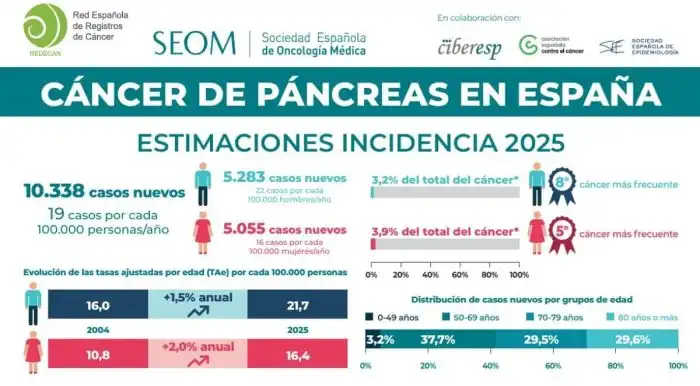 Aumento Alarmante de Cáncer de Páncreas en España: El Tabaquismo como Principal Culpable