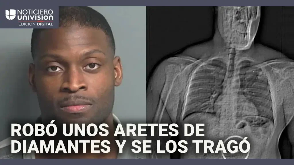 Un Robo Inusual: Hombre se Traga un Colgante Fabergé en Nueva Zelanda