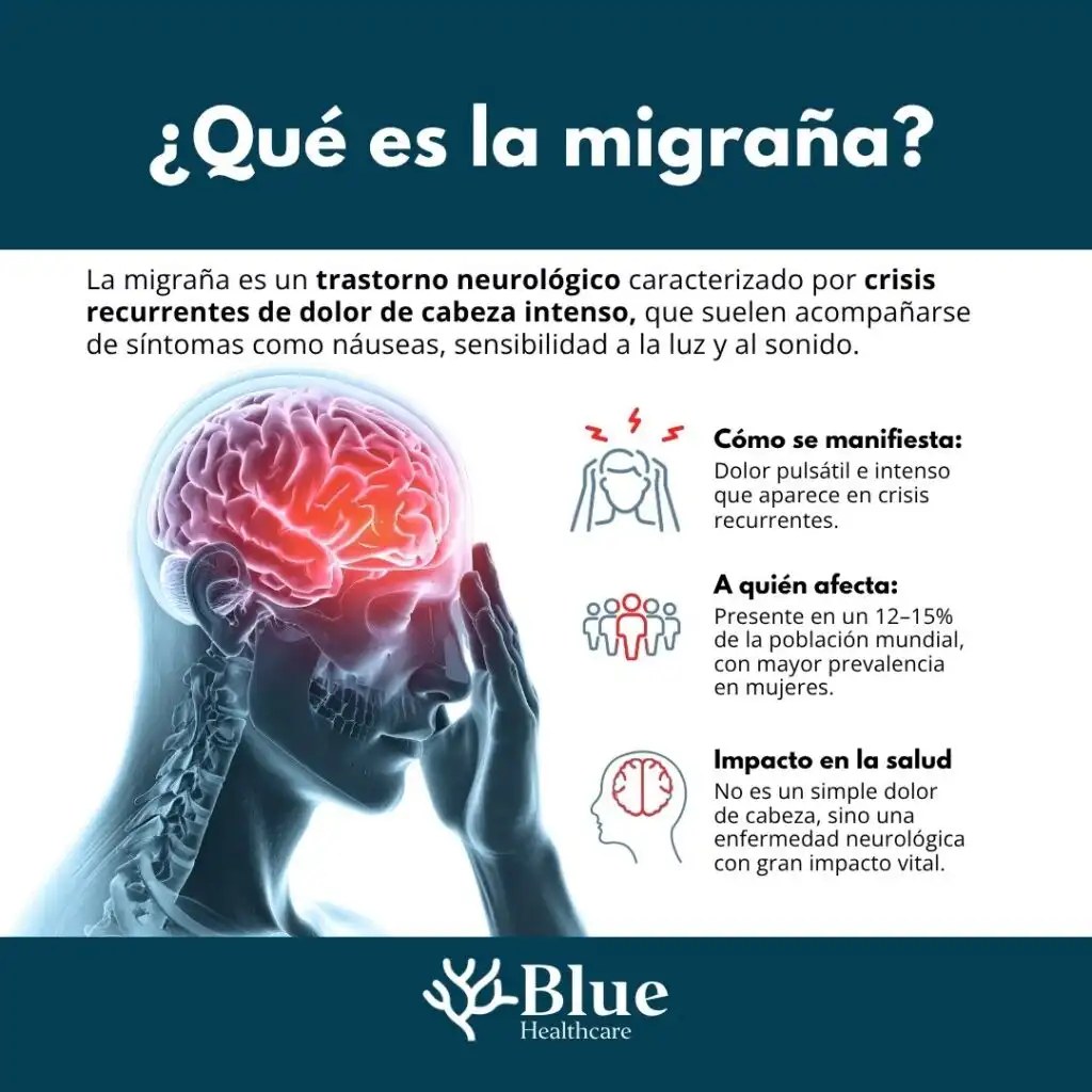 Migraña: Comprendiendo una Enfermedad Neurológica Común y Sus Tratamientos
