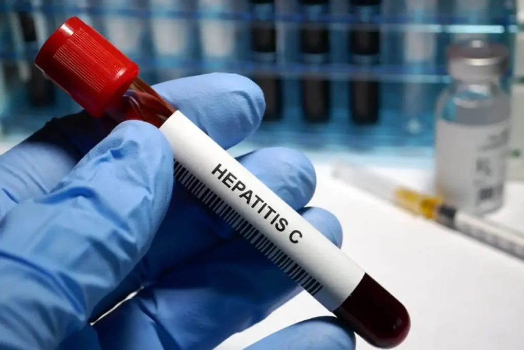 Avances en el Diagnóstico de la Hepatitis C: Una Prueba Rápida que Cambia el Juego