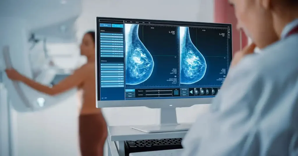 Avances en Radioterapia: Innovaciones que Transforman el Tratamiento del Cáncer