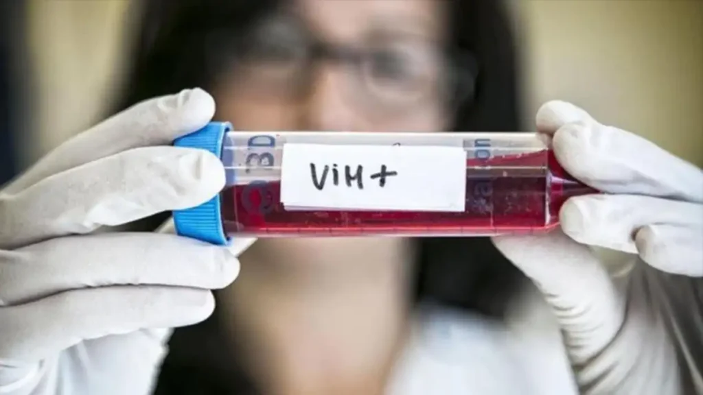 Avances en la Remisión del VIH: Un Caso Innovador de Trasplante de Células Madre