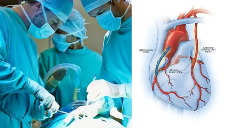Innovación Médica: Primer Bypass Coronario Sin Cirugía Abierta