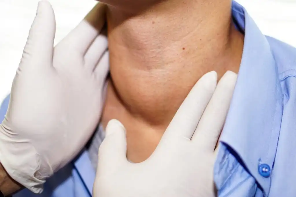 Bultos en el Cuello: Identificación y Cuándo Consultar al Médico
