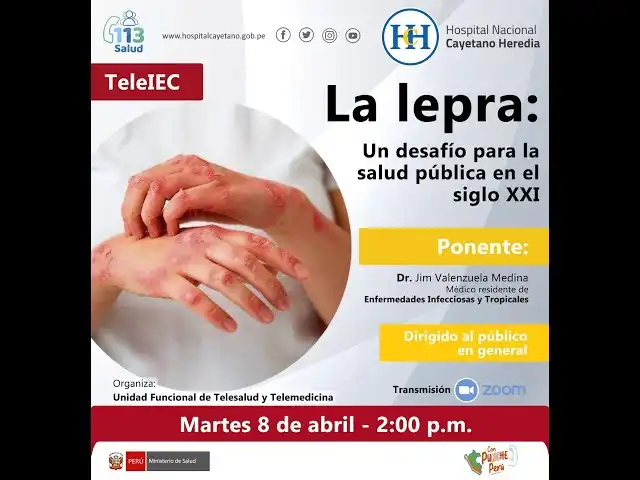 La Lepra: Un Desafío Global que Requiere Atención y Empatía