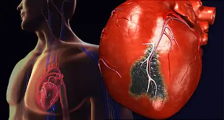 El Impacto del Tabaquismo Temprano en la Salud Cardiovascular