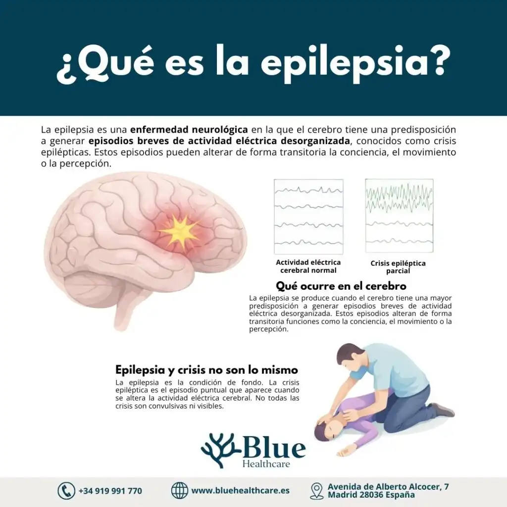 Comprendiendo la Epilepsia: Identificación y Actuación ante Crisis Epilépticas