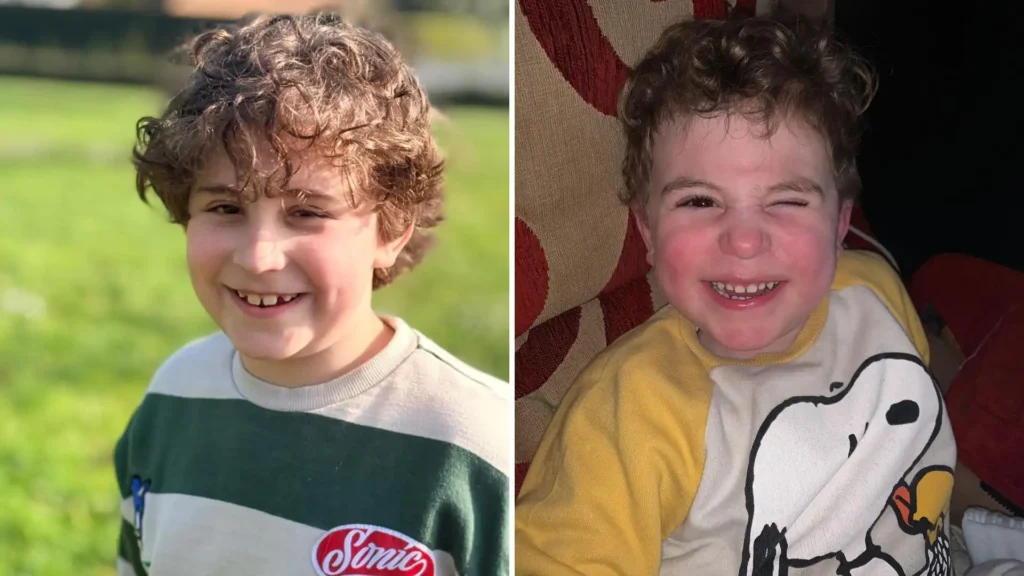 La Lucha de Olay: Un Niño y su Batalla Contra la Dermatomiositis Juvenil