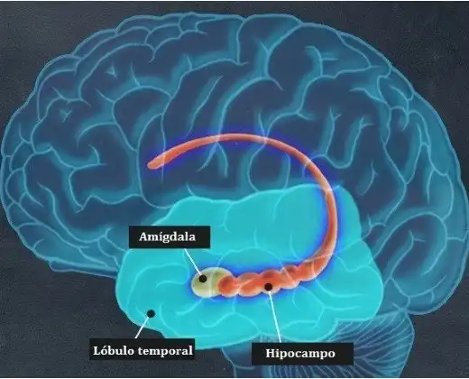Reguetón y cerebro: ¿por qué activa más zonas que Bach según la neurociencia?