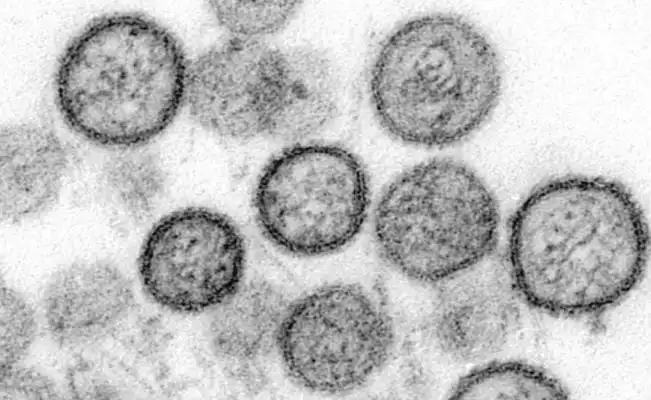 ¿Qué es el hantavirus y por qué este brote en un crucero del Atlántico preocupa a la OMS?
