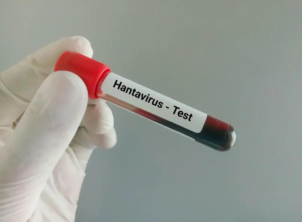 Hantavirus en crucero MV Hondius: tres muertes, cuarentena en Hospital Gómez Ulla y protocolo de repatriación
