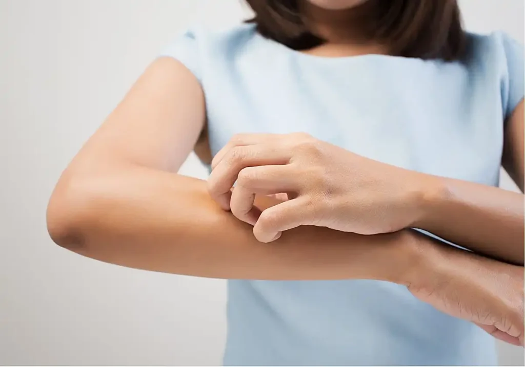 ¿Por qué a unas personas les pican más los mosquitos que a otras?
